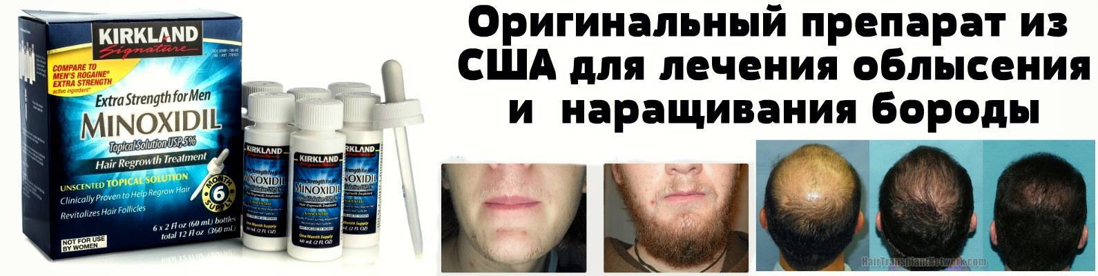 Волшебный андроген или отчего растут и выпадают волосы - unibeauty.ru