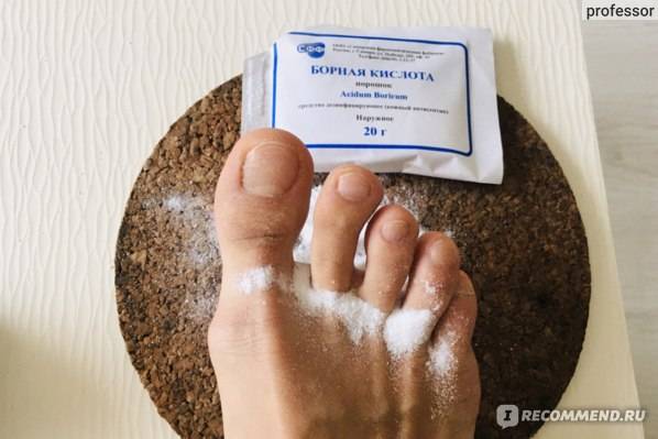 Борная кислота от грибка ногтей: лечение, отзывы, рецепты