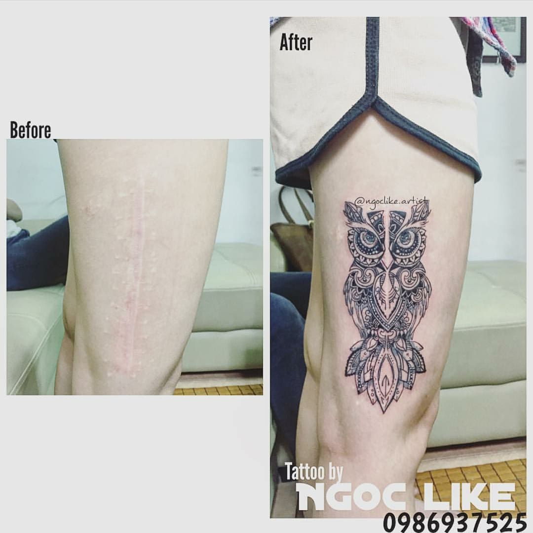 Тату на шрамах — выбор эскиза для перекрытия шрама татуировкой, фото работ до и после
