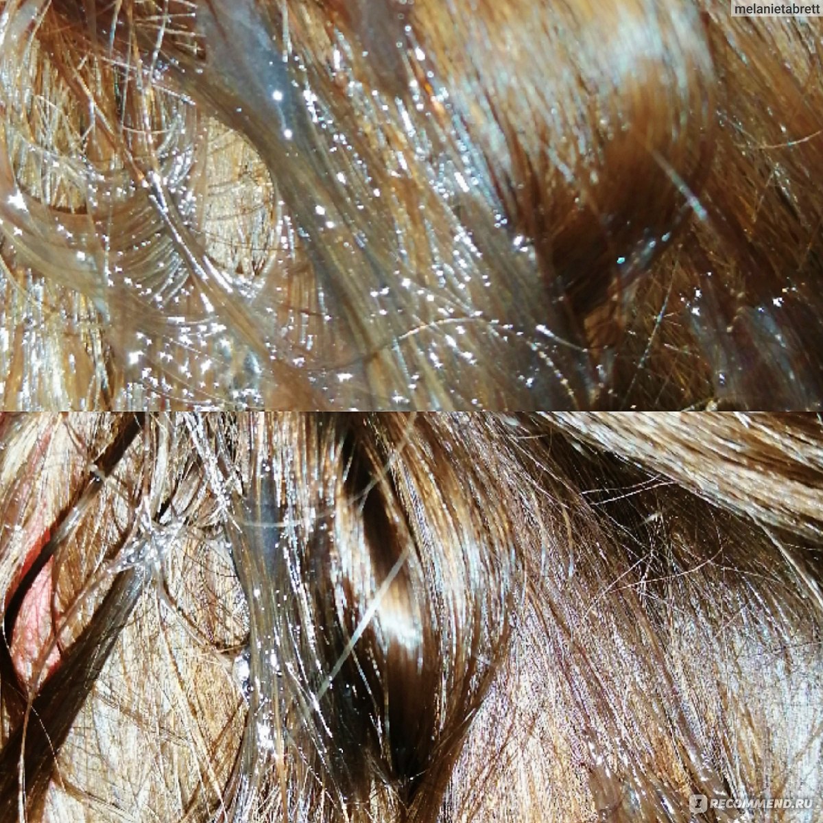 Секущиеся волосы. методы борьбы | блог expert clinics