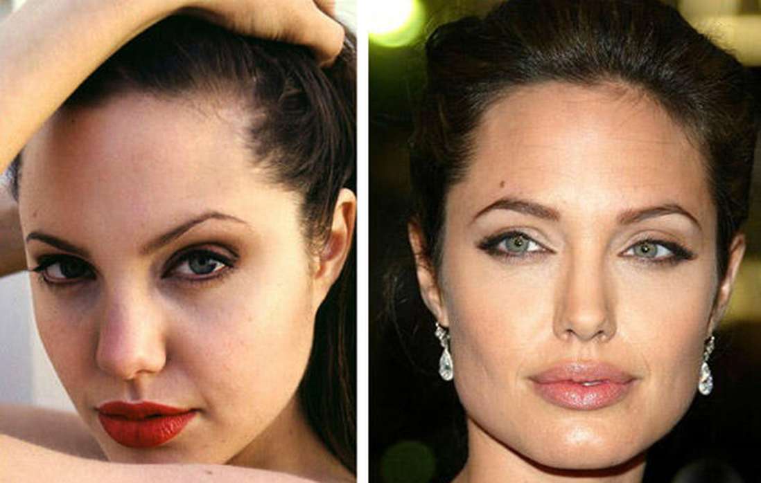 Изменение формы глаза. Анджелина Джоли ринопластика. Анджелина Джоли Лисьи глаза. Глаза Анджелины Джоли пластика. Анджелина Джоли до пластической операции.