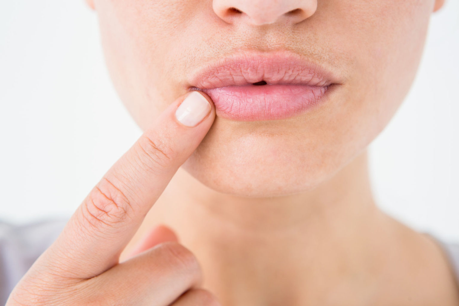 Обветрились губы — что делать? - тверской доктор - медицинский диагностический центр
