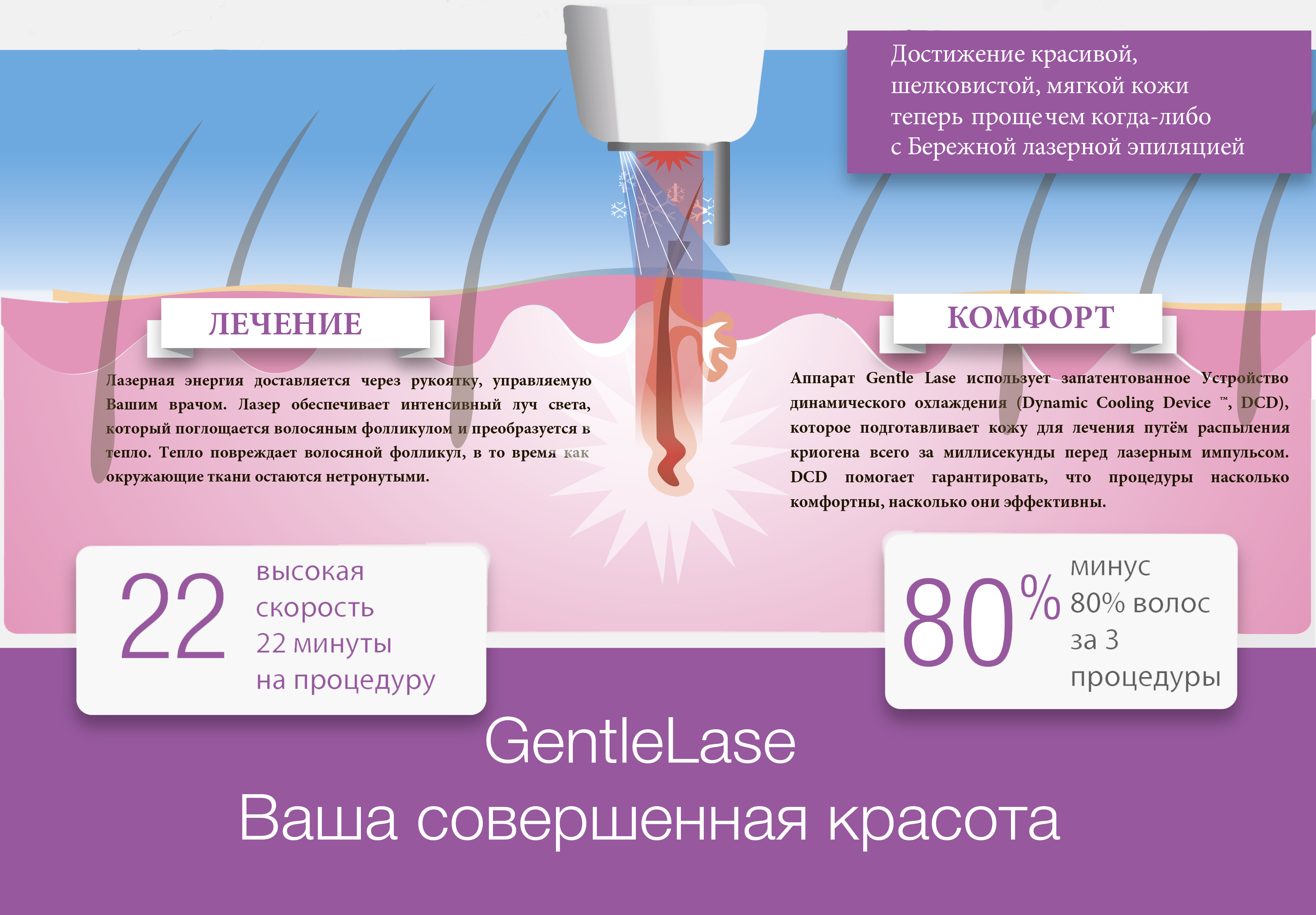 Элос эпиляция схема