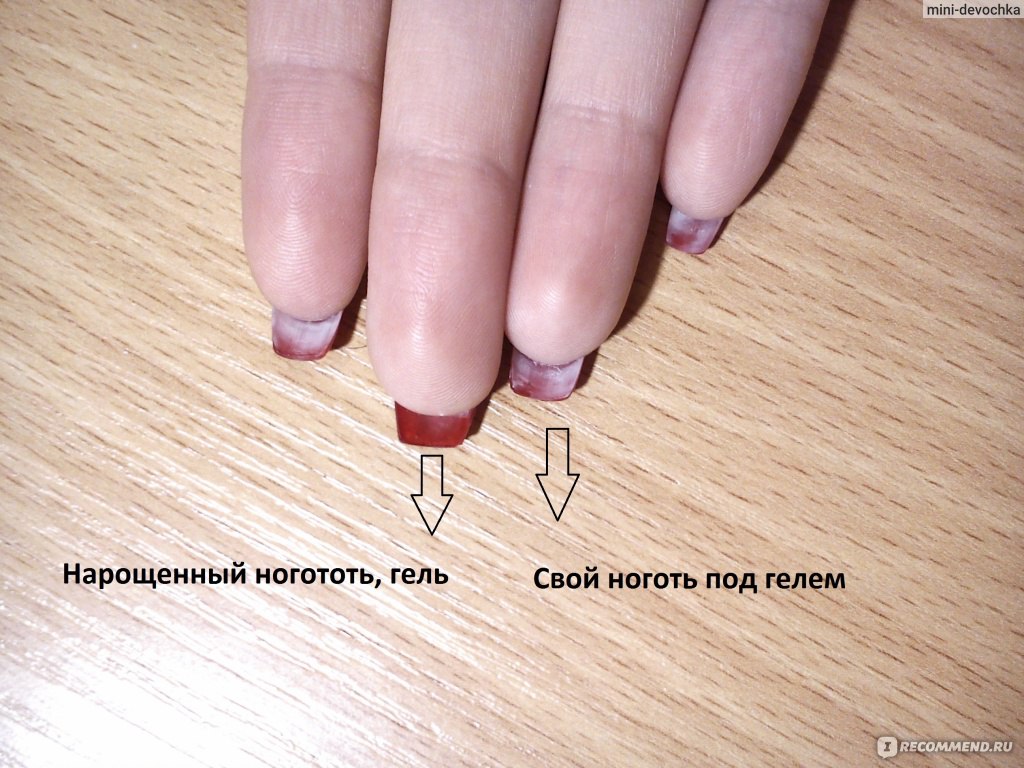 Слоятся ногти под гель-лаком, после гель-лака: причины, что делать? какая подойдет база для слоящихся ногтей, как наносить покрытие?