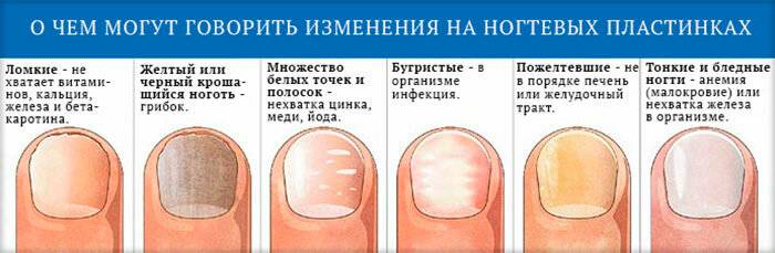 Лечение болезней и повреждений ногтей и кутикулы. о чём говорят деформации, ломкость и изменение цвета ногтей - медицинский центр «эхинацея»