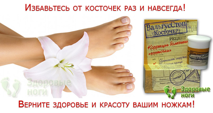 Вам тоже поможет мазь «Валгус про» — лучшее средство от косточки на ноге!
