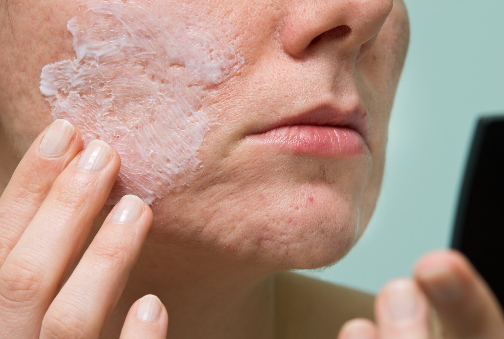 Гусиная кожа: причины, симптомы фолликулярного гиперкератоза | блог expert clinics