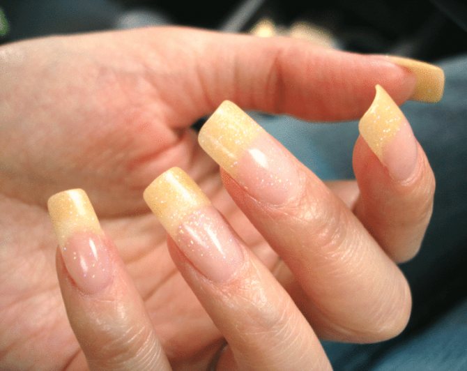 Желтые ногти на руках причины и  доступные способы лечения.