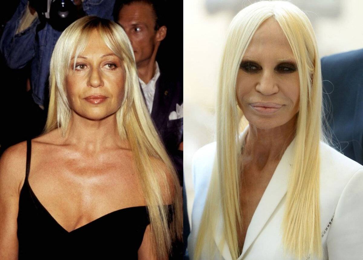 Донателла версаче, итальянский модельер сменила внешность до неузнаваемости, фото в молодости и после операции