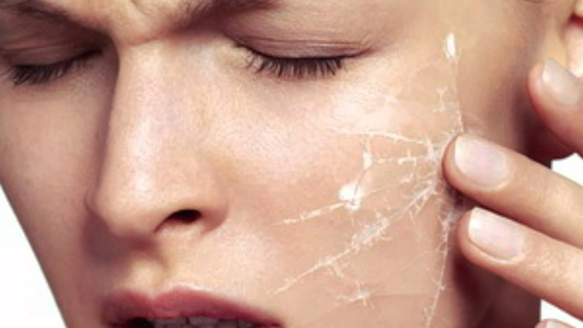 Шелушение кожи на теле: 7 причин и обзор 11 средств с отзывами