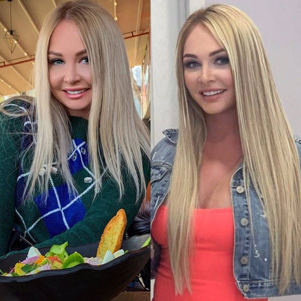 Дарья пынзарь сделала пластическую операцию (увеличение груди) – фото до и после
