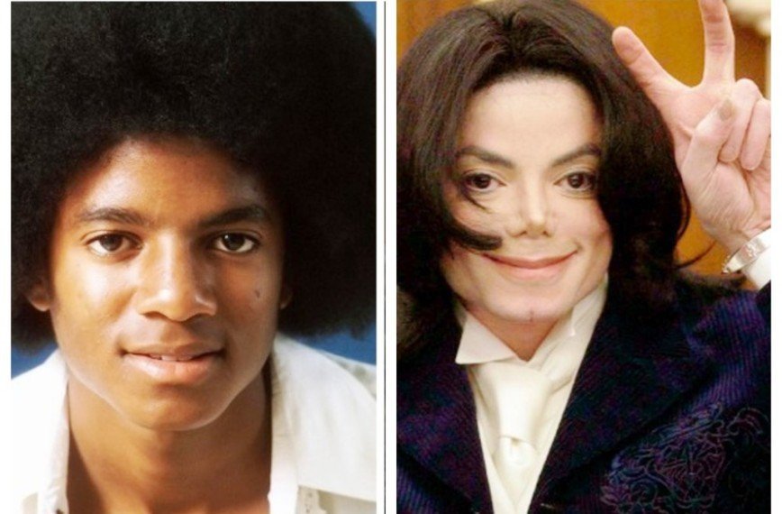 Майкл джексон до и после пластических операций, фото и видео