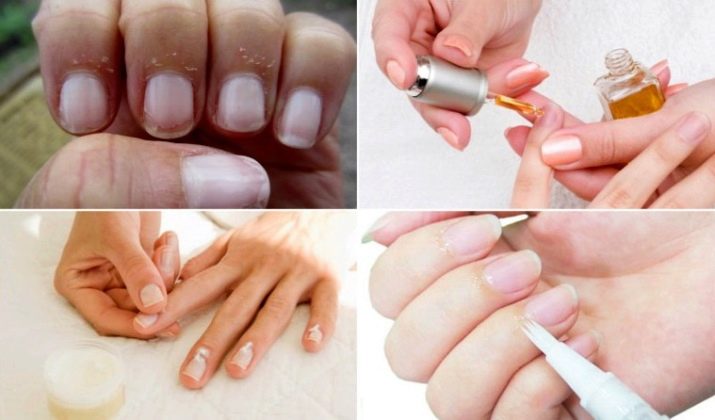 Как правильно ухаживать за ногтями после маникюра