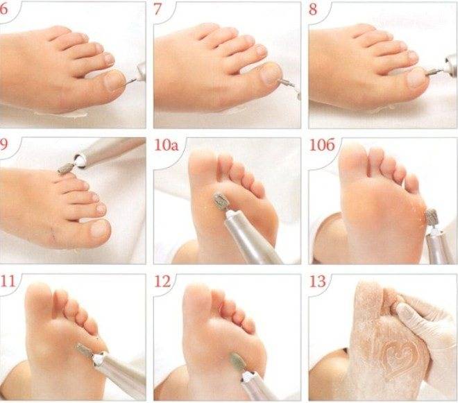 Французский педикюр: как сделать френч на ногах в домашних условиях своими руками