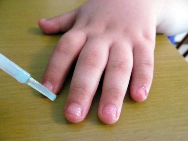 Советы как эффективно отучить ребенка грызть ногти: простые способы и рекомендации как отучить легко и быстро от вредной привычки (110 фото + видео)