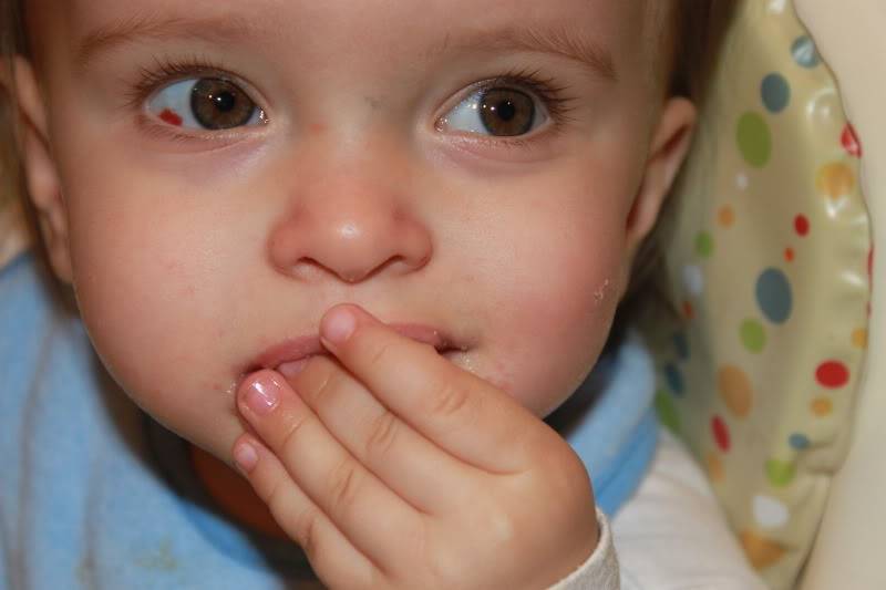 Чем опасен блефарит у детей? каковы основные симптомы и в чем заключается лечение заболевания?