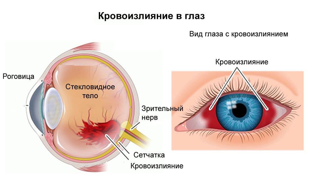 Отеки лица и глаз: симптомы, признаки возникновения, методы лечения отеков лица и глаз по утрам  | блог expert clinics