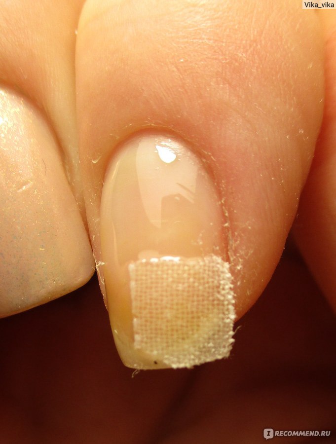 Почему трескается гель-лак на ногтях: причины трещин на натуральных и нарощенных ногтях, что делать