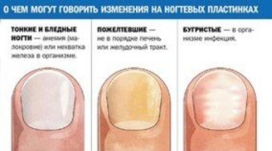 Лунки на ногтях: значение для здоровья