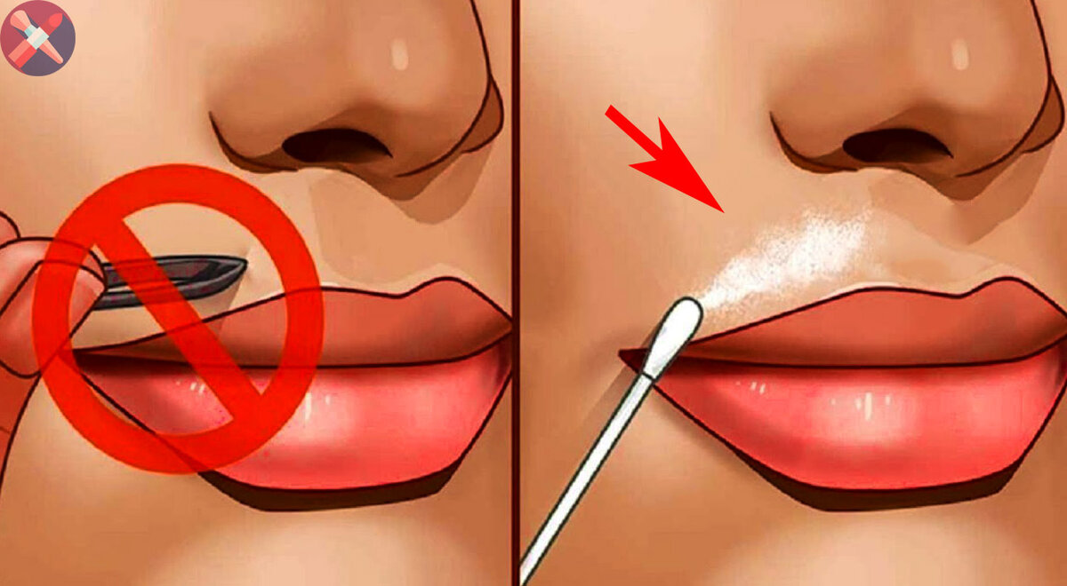 Как навсегда избавиться от усов с помощью эпиляций