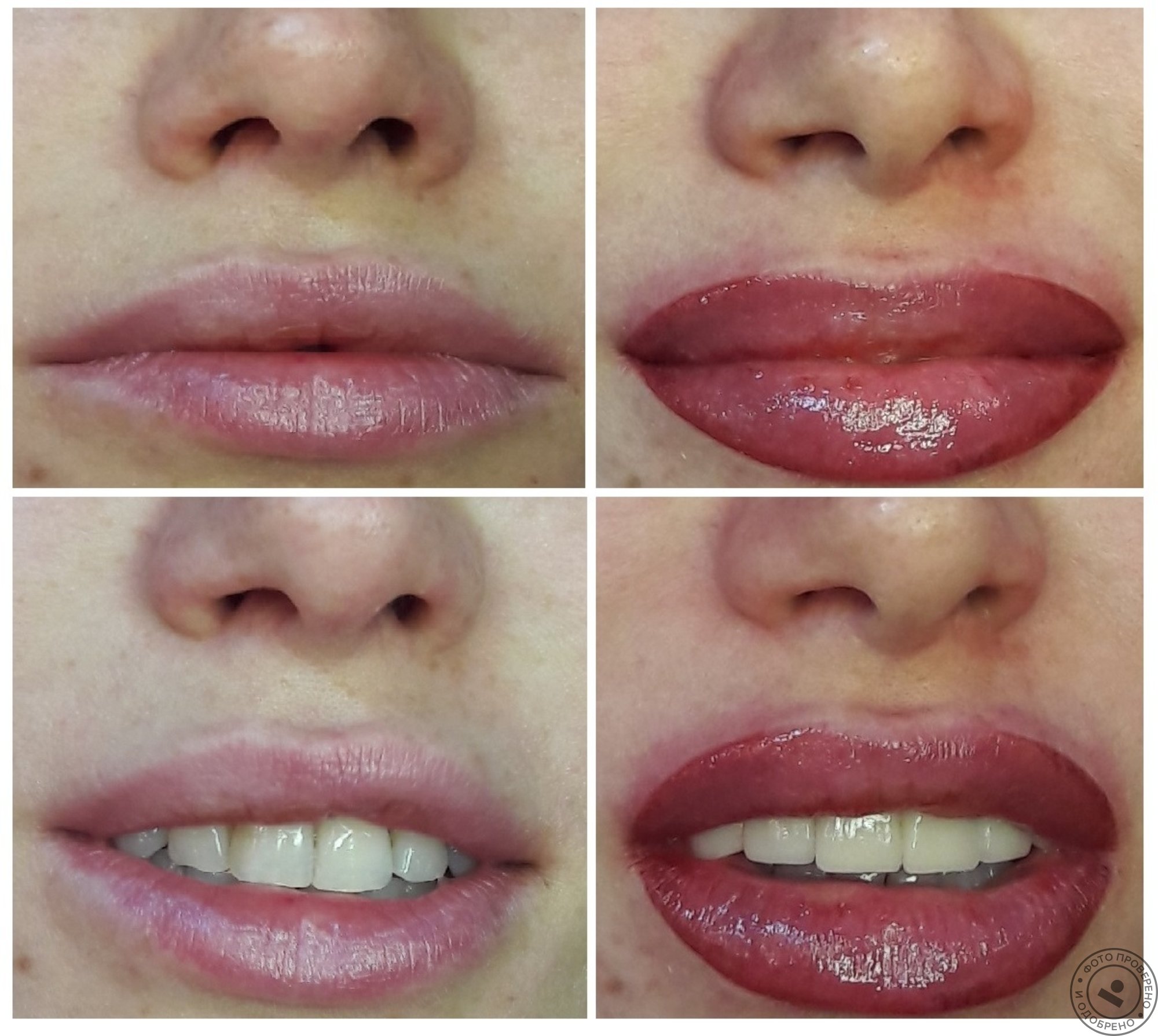Татуаж или увеличение губ. Татуаж губ. Перманент губ. Перманентный макияж губ. Татуаж губ до и после.