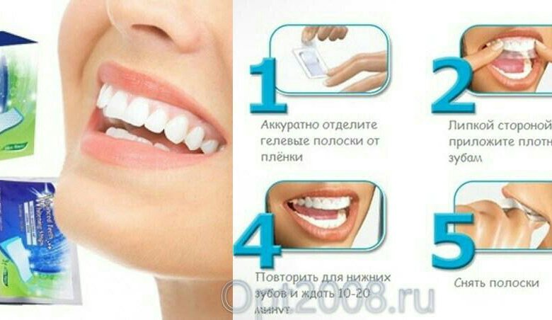 Как отбеливающие полоски влияют на зубную эмаль
