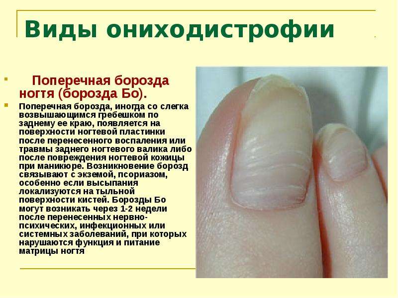 Основные заболевания ногтей